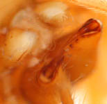 Allomengea vidua - chelicerae (c) Mueller