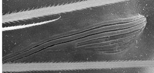 Amaurobius fenestralis - lyriform organ (c) ZFMK spider course 2005