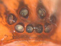 Anyphaena accentuata - eyes (c) Ziewer
