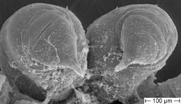 Atypus piceus - larva chelicerae (c) ZFMK Spider Course 2005