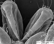 Atypus piceus - nymph chelicerae (c) ZFMK Spider Course 2005