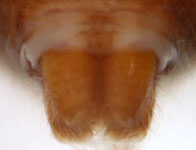 Cheiracanthium sp. - spinnerets (c) Funke