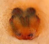 Clubiona terrestris - epigynum (c) ZFMK spider course 2004