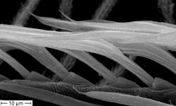 Dictyna uncinata - female calanistrum detail (c) ZFMK spider course 2005