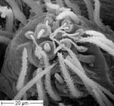 Dictyna uncinata - female PMS (c) ZFMK spider course 2005