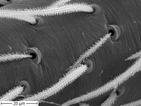 Dictyna uncinata - trichobothria (c) ZFMK spider course 2005