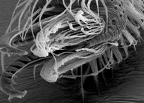 Dysdera crocata - hairs on tarsus (c) ZFMK Spider Course 2005