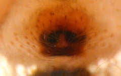 Enoplognatha ovata - epigynum (c) Mpangara