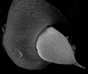 Gonatium rubens - hair on palp (c) ZFMK spider course 2004