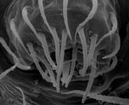 Gonatium rubens - male ALS (c) ZFMK spider course 2004