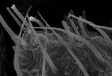 Gonatium rubens - male PLS (c) ZFMK spider course 2004