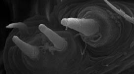 Gonatium rubens - male PMS (c) ZFMK spider course 2004