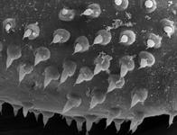 Gonatium rubens male femur (c) ZFMK Spider Course 2005