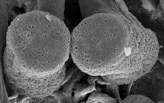 Larinioides sclopetarius - receptacles (c) ZFMK spider course 2005