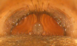 Linyphia triangularis - epigynum (c) Funke