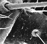 Linyphia triangularis - trichobothrium and spine on female palp (c) ZFMK spider course 2004