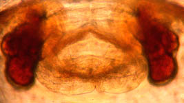 Metellina merianae - cleared epigynum (c) Roesel/Vollmer