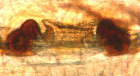 Metellina segmentata - cleared epigynum (c) Roesel/Vollmer