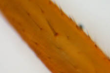 Microlinyphia pusilla - spine (c) Lange