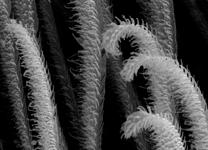 Micrommata virescens - scopula hairs (c) ZFMK spider course 2005