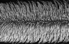 Micrommata virescens - metatarsus 2 ventral (c) ZFMK spider course 2005