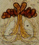 Myrmarachne formicaria - cleared epigynum (c) Linke/Borggrefe