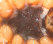 Neoscona adianta - sternum (c) Struebing, Arndts