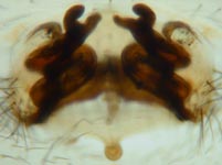 Neriene emphana - cleared epigynum (c) ZFMK spider course 2005