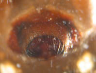 Neriene montana - epigynum (c) Ratering