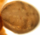 Pachygnatha listeri - abdomen (c) Naber