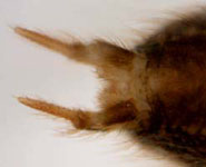 Textrix denticulata - spinnerets (c) Schwarzer