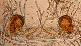 Zodario sp. - cleared epigynum (c) Linke/Borggrefe